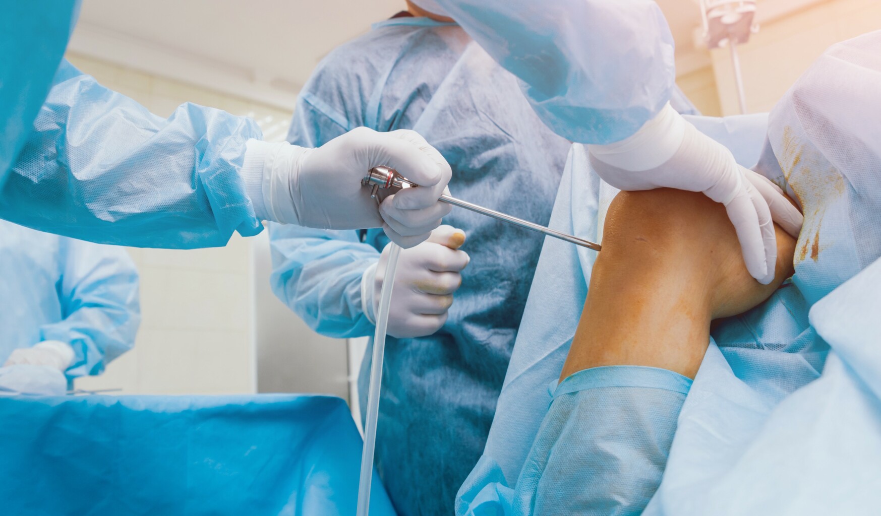 Arthroscopy