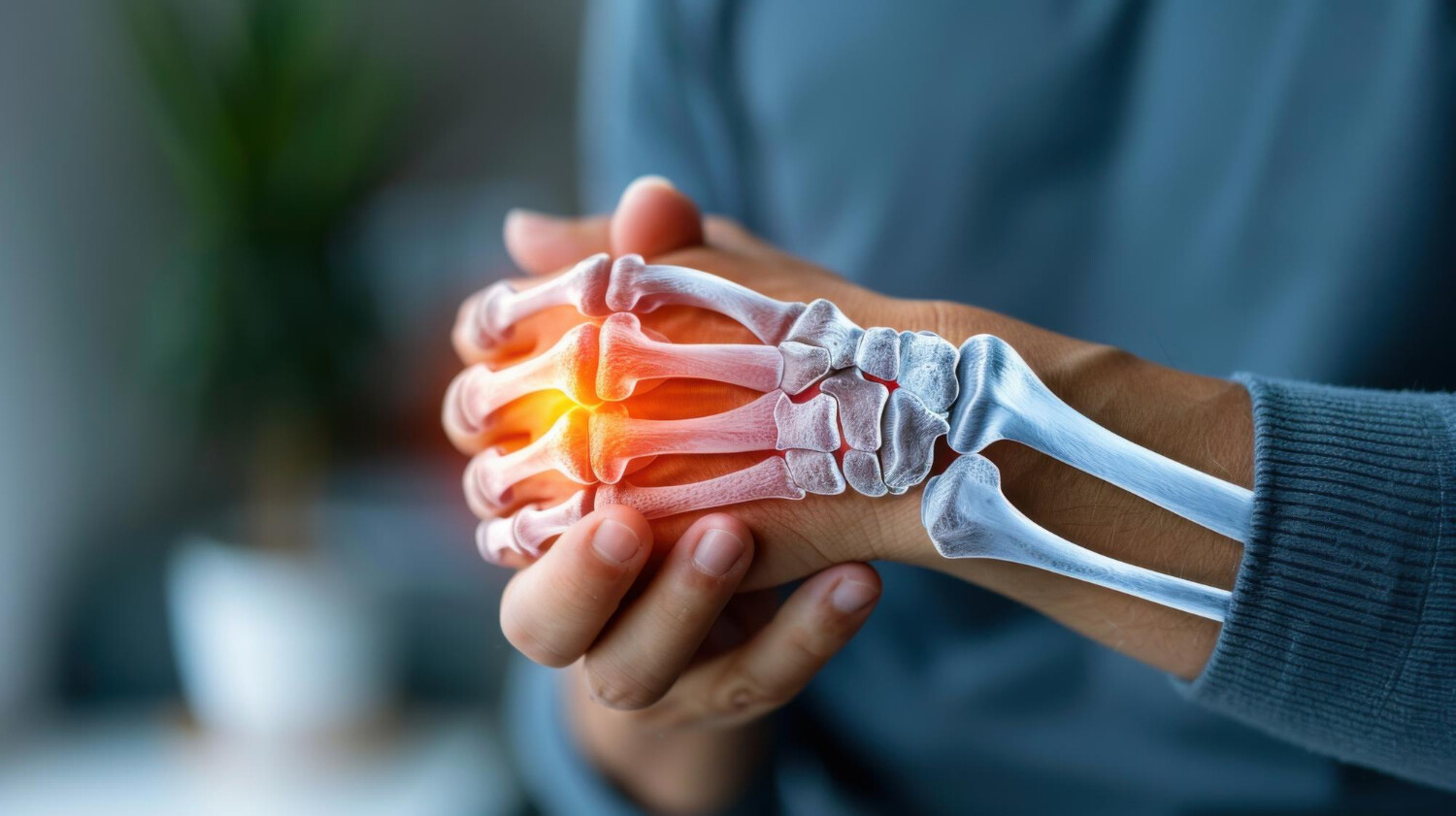 Rheumatology